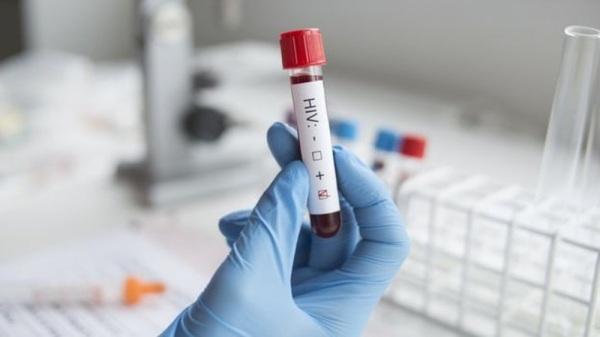 Cruz Alta registra redução no número de novos casos de HIV/Aids