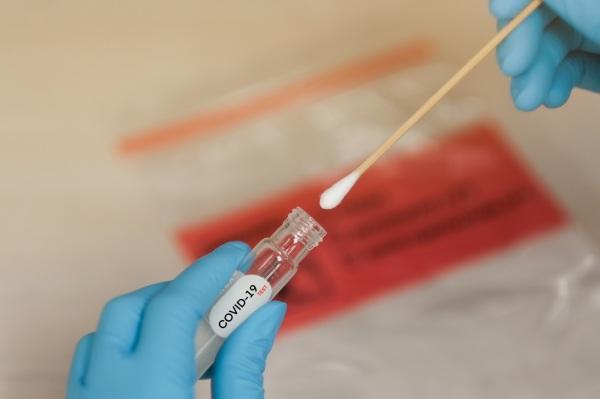 Procura por teste rápido de Covid-19 aumenta nas farmácias de Cruz Alta