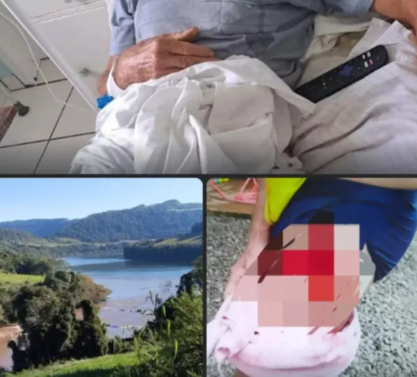 Pescador é atacado em rio por animal desconhecido  em Maximiliano de Almeida