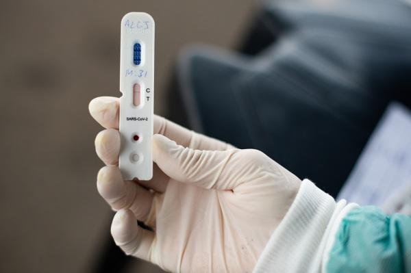 Cruz Alta recebe testes rápidos de COVID-1, através do Ministério da Saúde