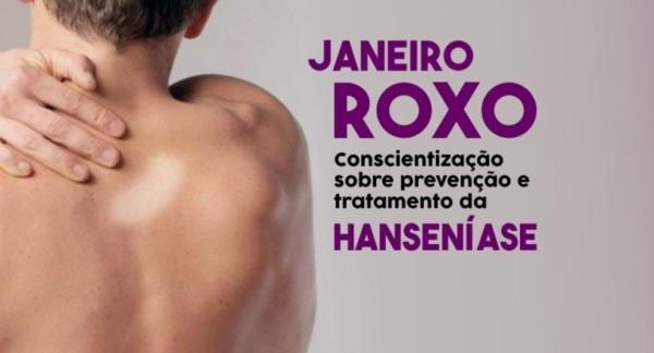 JANEIRO ROXO: Cruz Alta não registra casos de Hanseníase há quatro anos