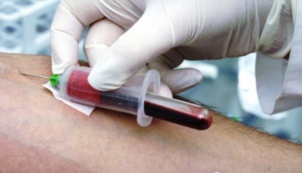 Medula Óssea: Hemocentro possui quase 18 mil doadores cadastrados no Redome