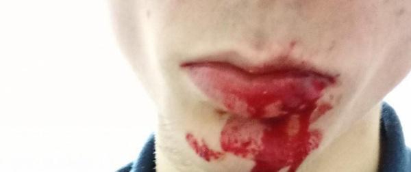 Jovem é Espancado em Cruz Alta e Vídeo Viraliza nas Redes Sociais
