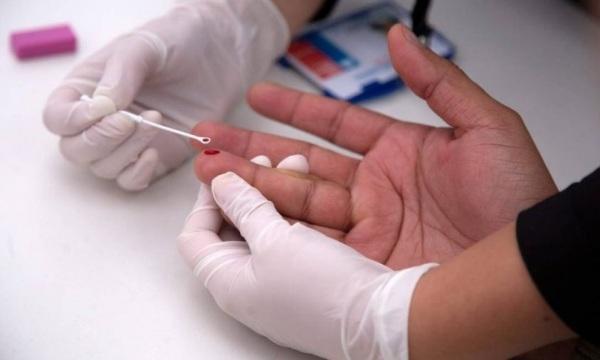 SAE registra redução no número de casos novos de HIV/Aids em 2022