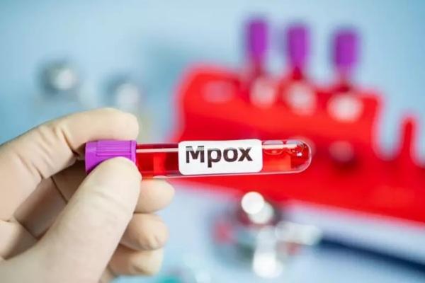 Mpox: diretor do Ministério da Saúde tira dúvidas sobre a doença