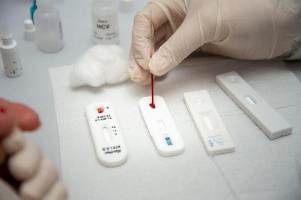 Reduz o número de casos de HIV/AIDS em Cruz Alta no ano de 2022