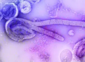EM NOVO HAMBURGO> Caso suspeito de Ebola é investigado no Rio Grande do Sul