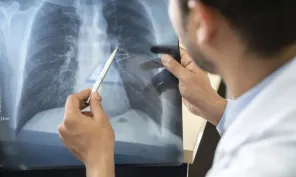 Tabagismo é maior entre jovens de 16 a 24 anos, alerta pesquisa